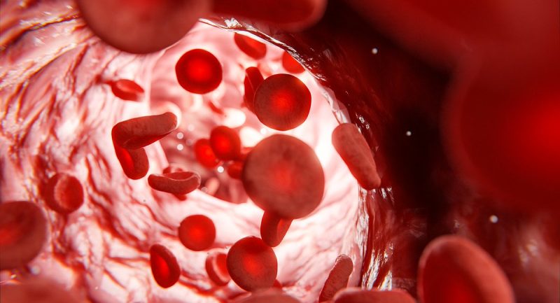 Luspatercept: A Transformative Therapy for Transfusion-Dependent Myelodysplastic Syndromes
