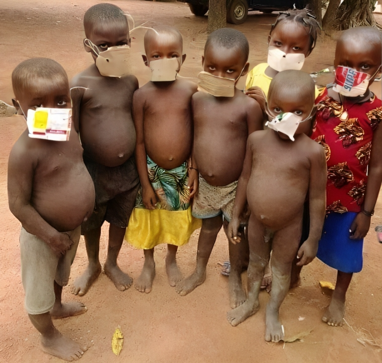 Mukhtasar Malcolm Alkali: AFRICA AND FUTURE HEALTH CRISIS 