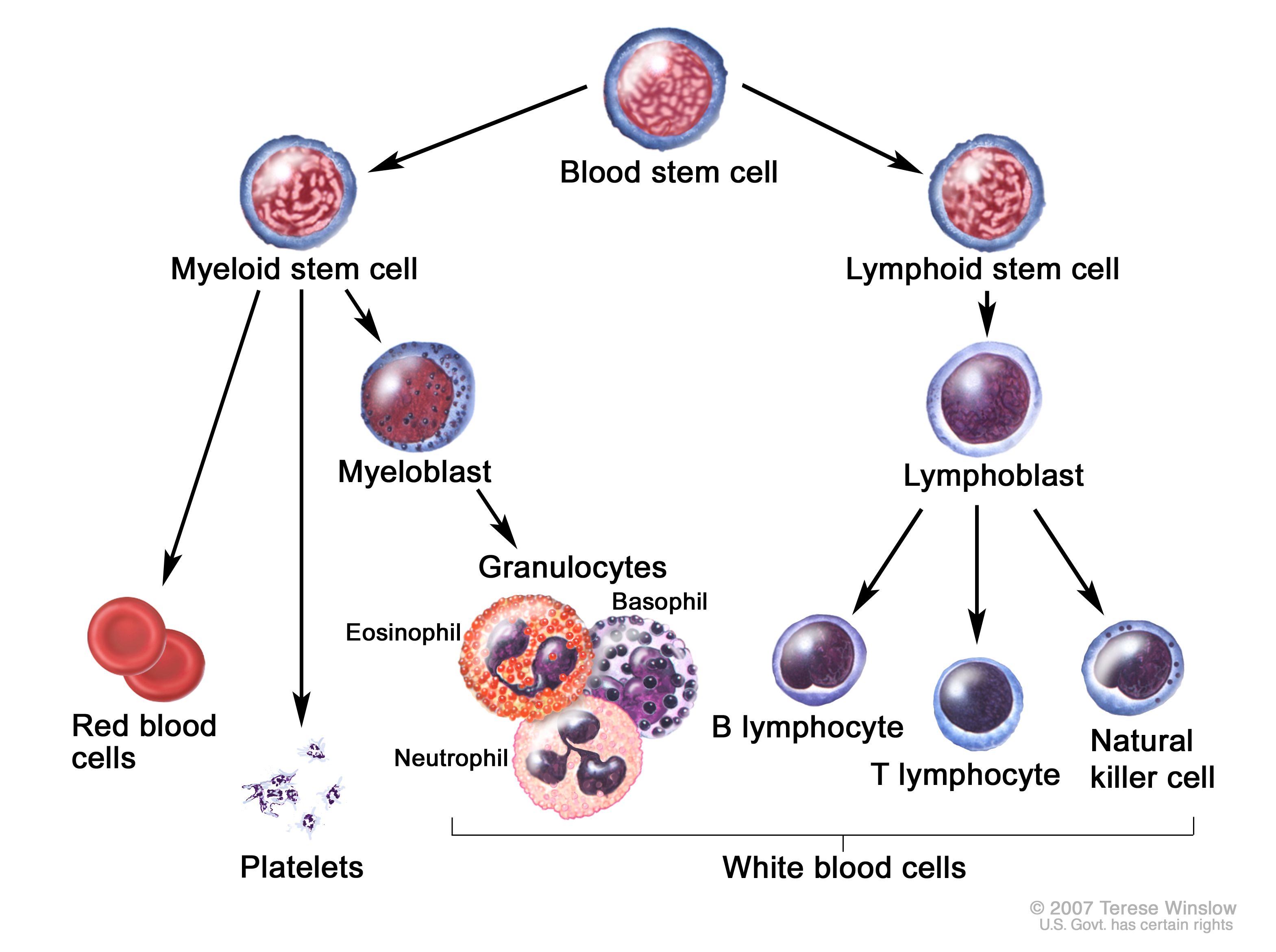 Types of Acute Lymphoblastic Leukemia