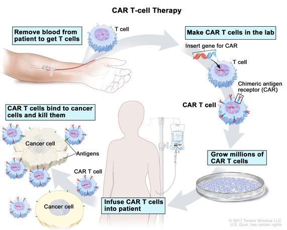 CAR T Cell therapy process; This image is taken from the cancer.gov