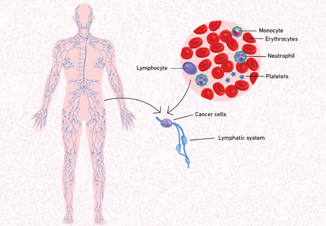 follicular lymphoma 