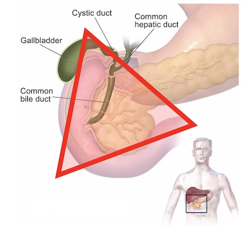 Gastrinoma