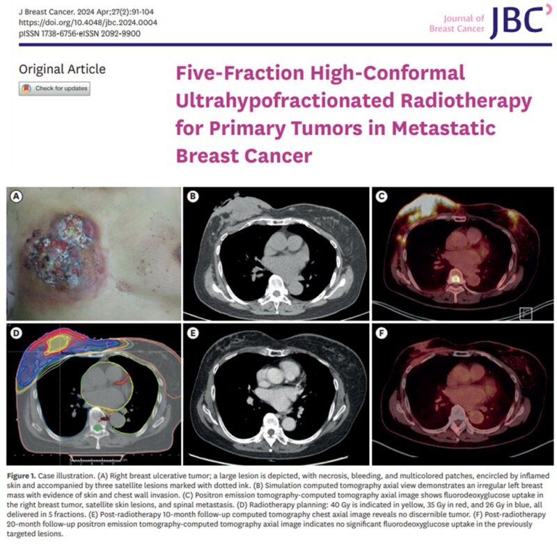 Yonsei Cancer Center paper