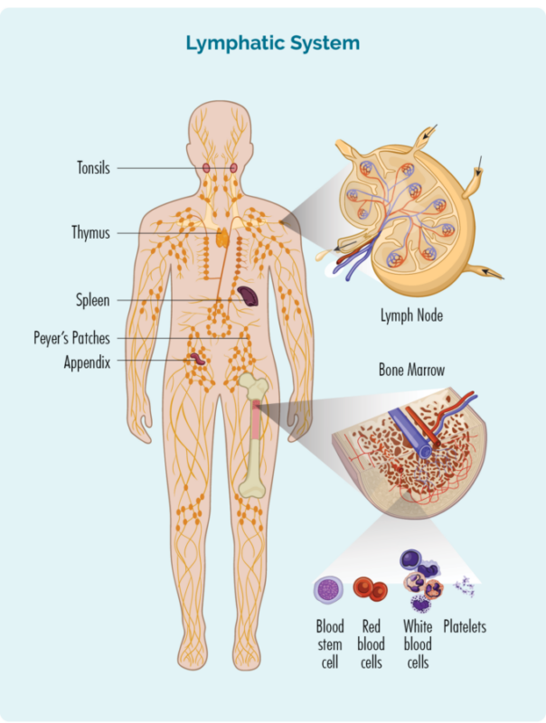 Diffuse large B-cell lymphoma