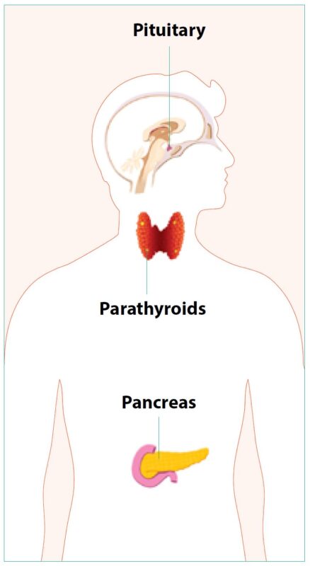 Multiple Endocrine Neoplasia Type 1 (MEN1)