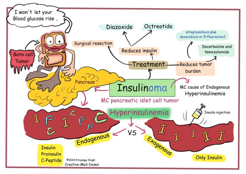 Insulinoma