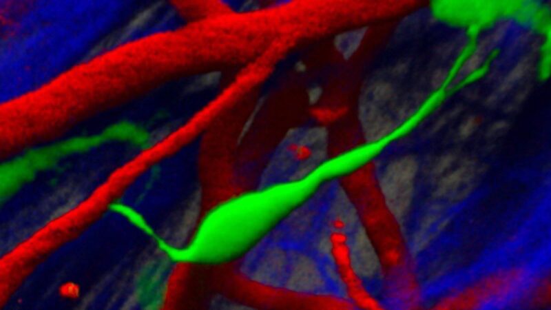 Glioblastoma, Nature Communications