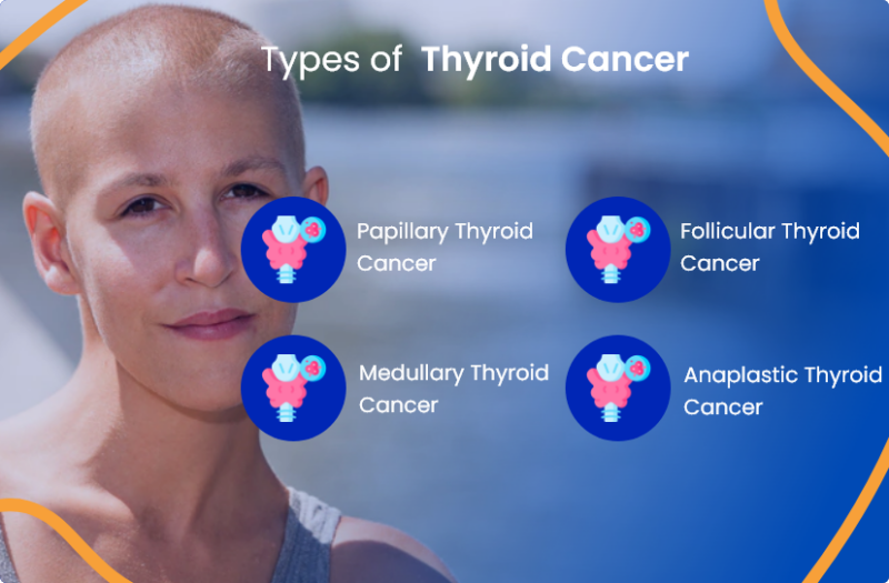 Thyroid Cancer