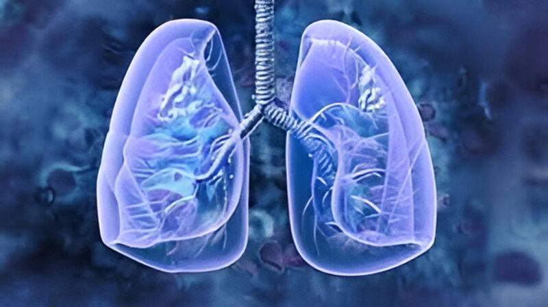Biagio Ricciuti: Resistance mechanisms in insertion-mutant NSCLC