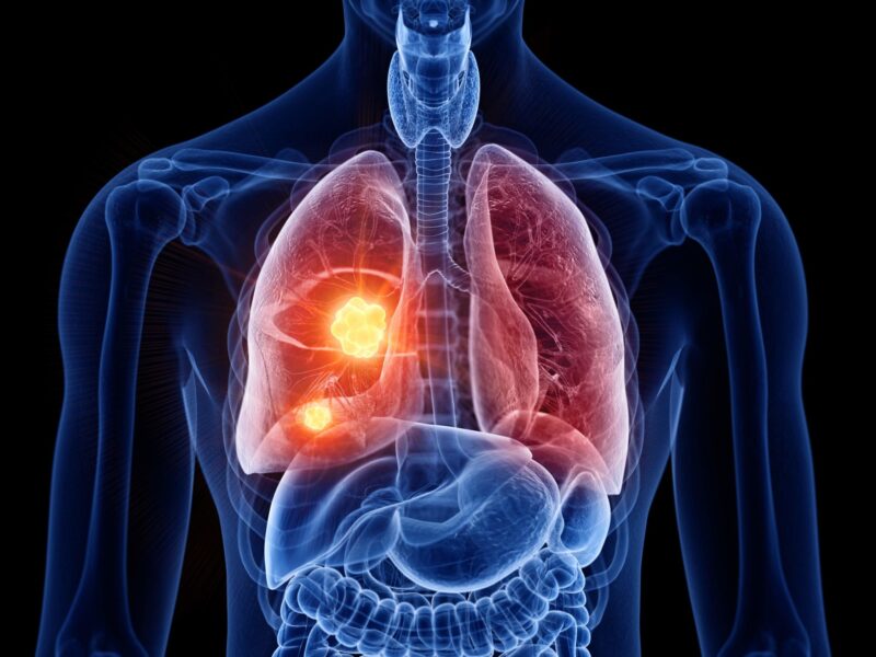 IASLC – Apply now for $7,500 toward travel, registration, and participation in WCLC24