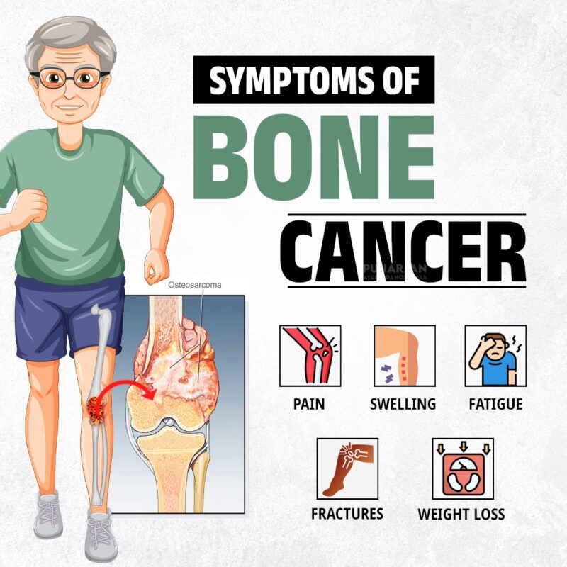 Bone cancer