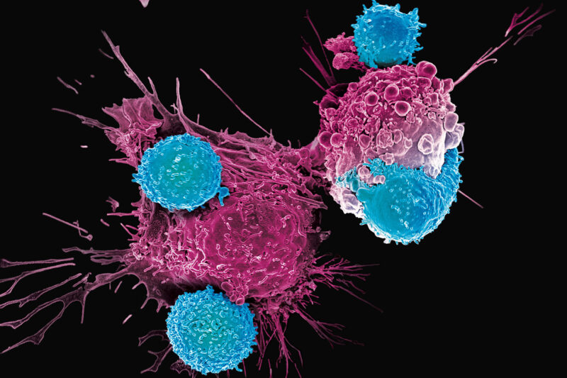 Rahul Banerjee: IL-18: magnifying glass, rejuvenating cream, and phone-a-friend all in one for T cells