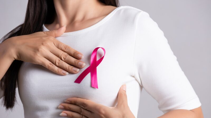 Maria Carmen De Santis: Significance of HER2-Low in DCIS of the breast