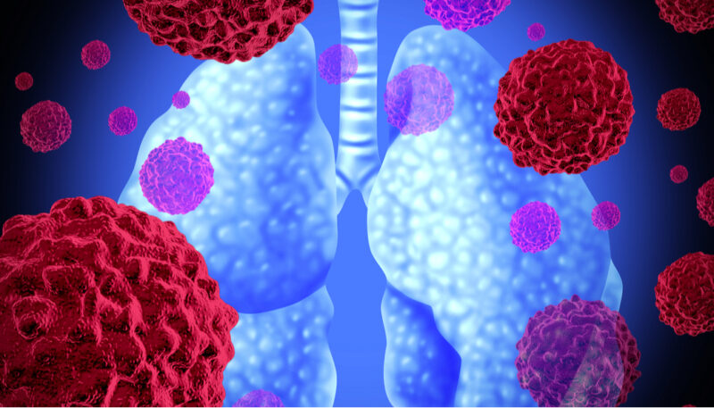 Brigatinib in ROS1 NSCLC