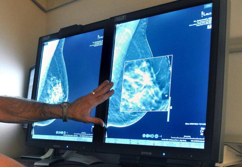 History of cancer screening in the EU – Lung Cancer Policy Network