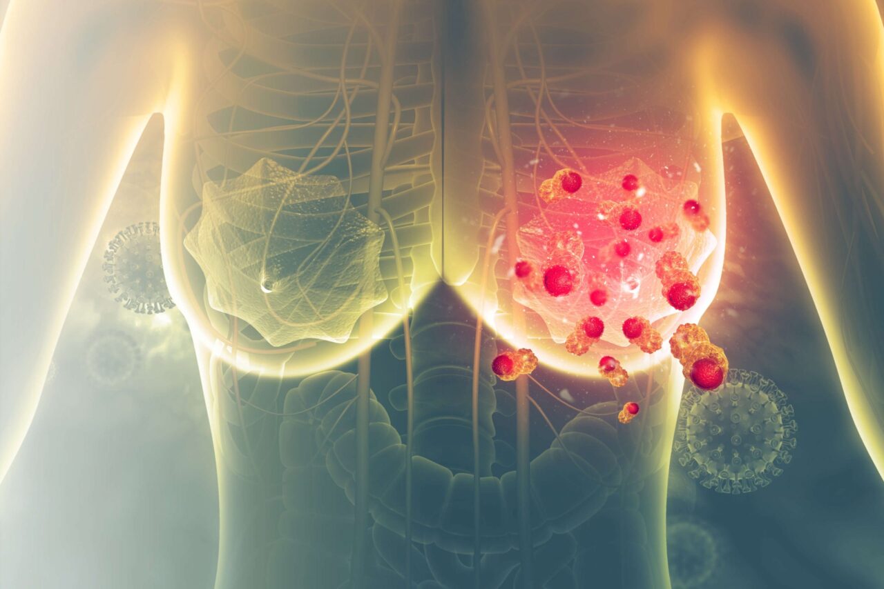 The results of the IMpassion132 trial