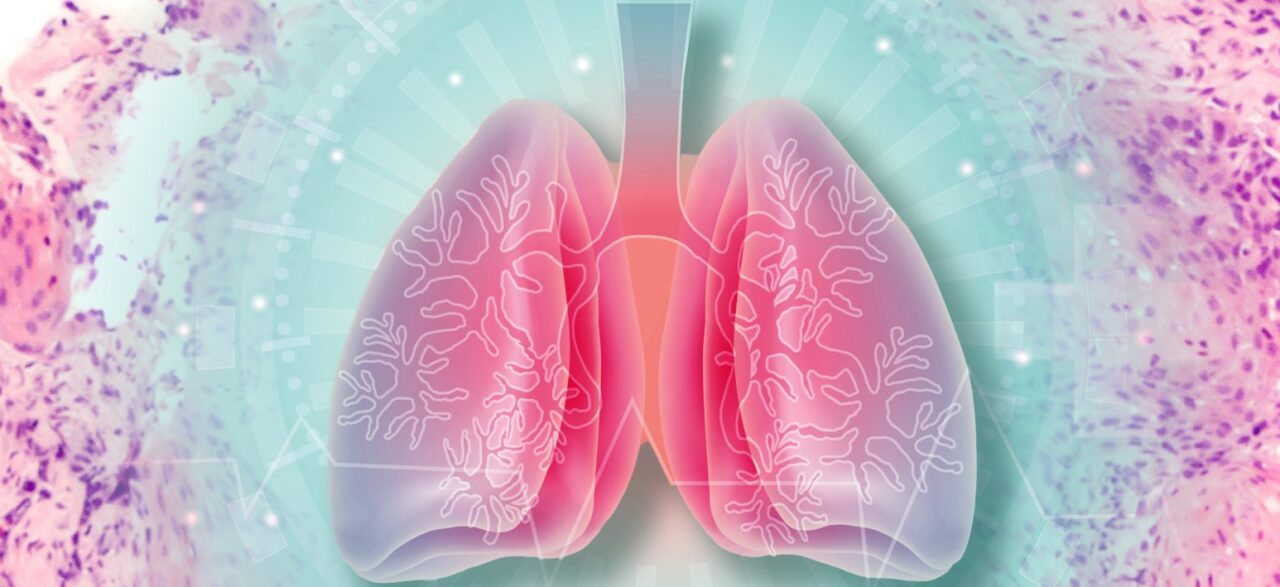 Jill Barnholtz-Sloan: New way to map whole tissue slides