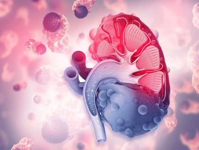 Kimryn Rathmell: New clues about possible causes of kidney cancer