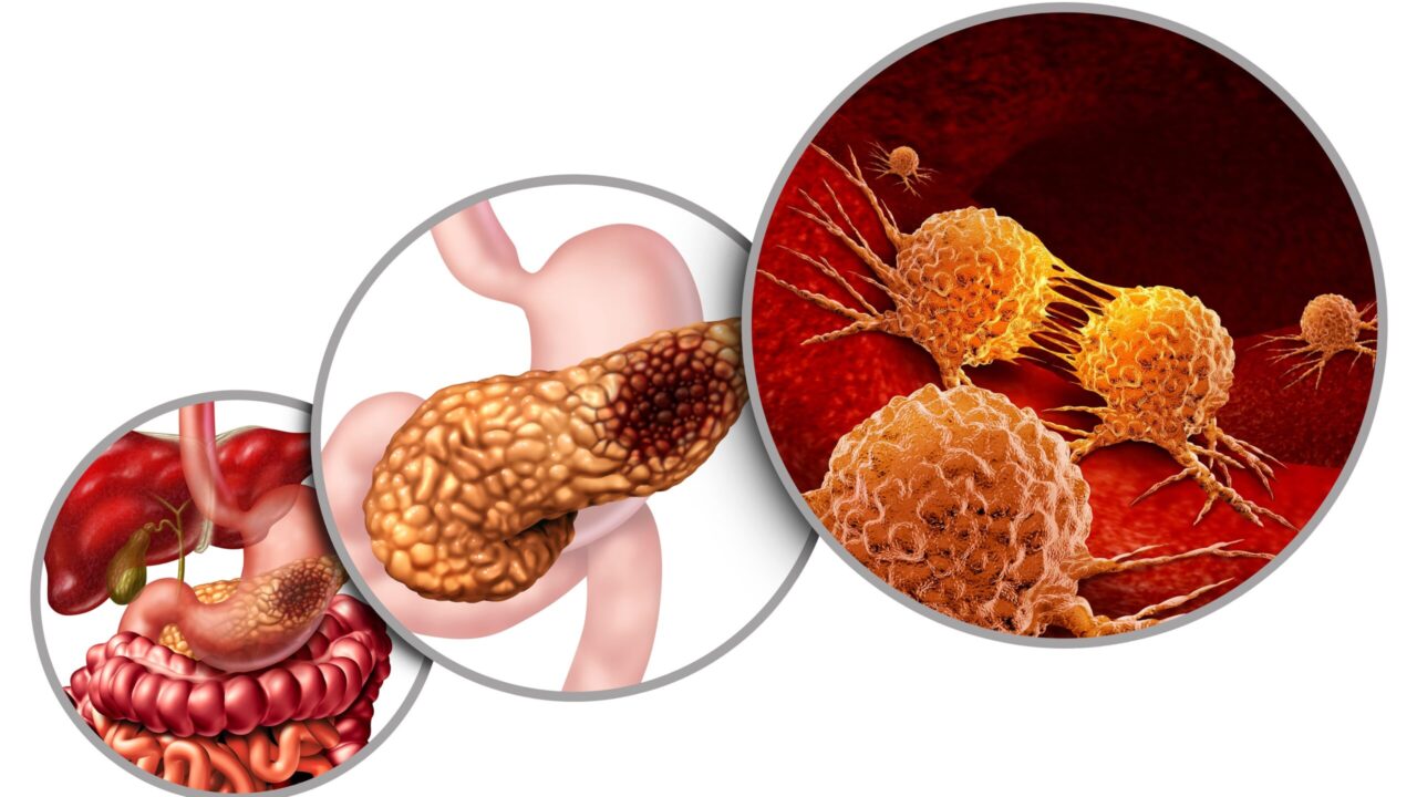 New human fetal pancreatic organoid model generates all three key cell types of the pancreas
