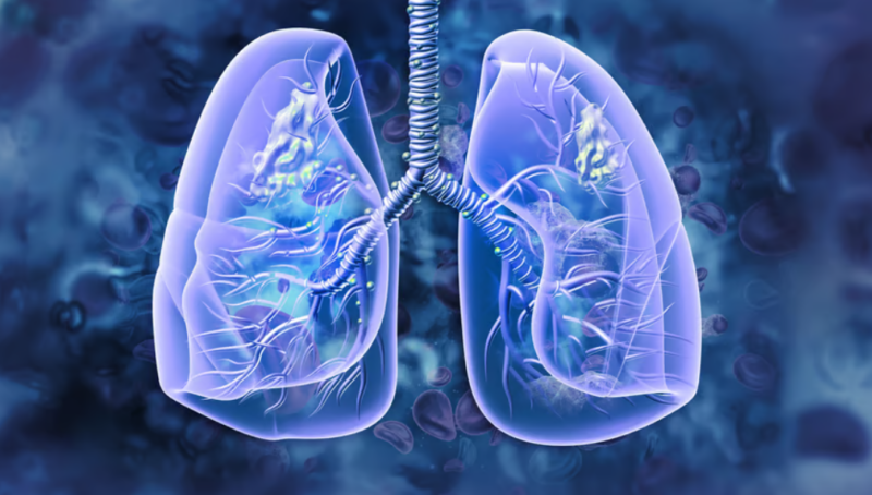 Bichoy Gabra: An illustration of the genes and pathways associated with targeted drugs for NSCLC
