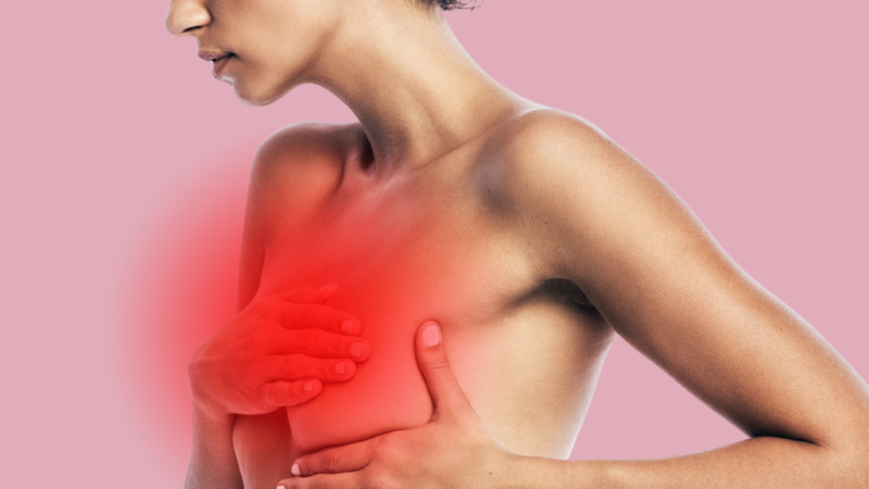 Dose-Dense vs Standard Adjuvant Chemotherapy for High-Risk Early Breast Cancer