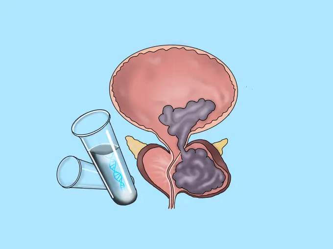 Genetic Testing in Men With mCRPC