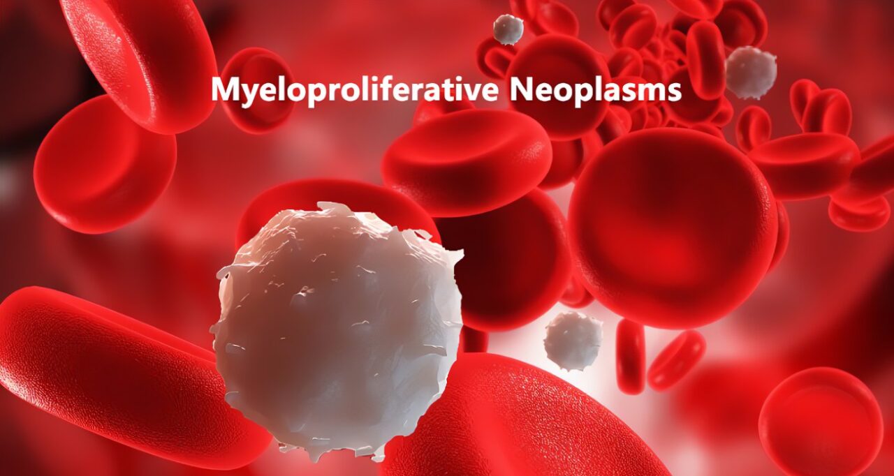 Gary Reuther: SHP2 may be a therapeutic target for patients with MPNs
