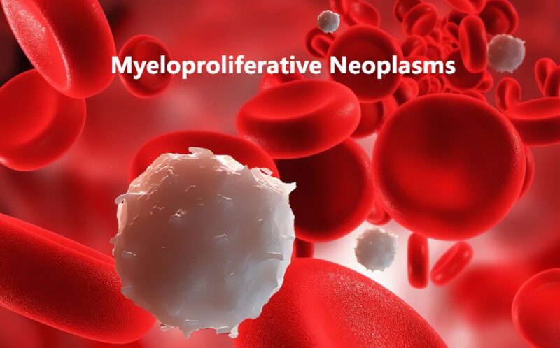 Gary Reuther: SHP2 may be a therapeutic target for patients with MPNs