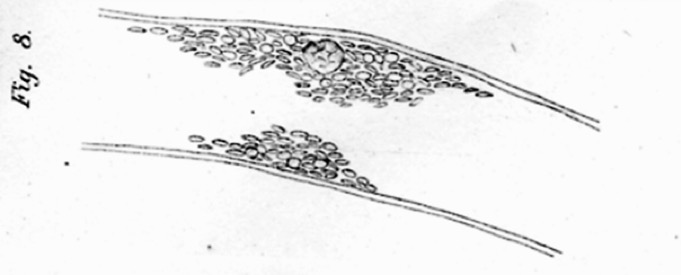 history of blood