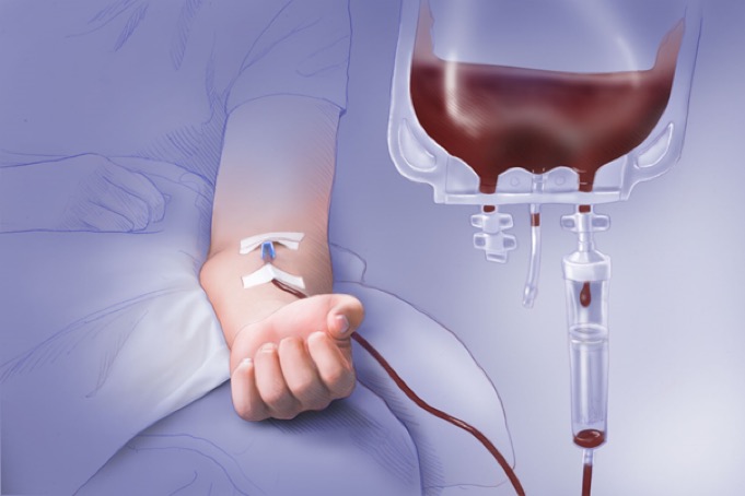 history of blood