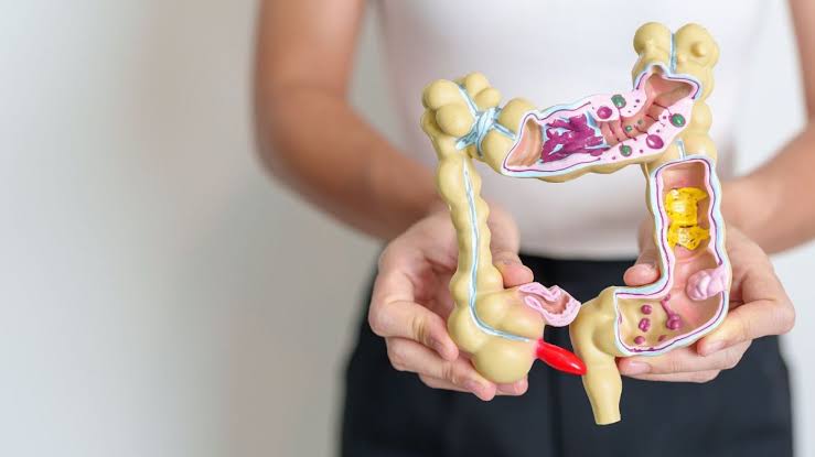 Incredibly relevant study on immunotherapy in msi-h mCRC – Foxpaws Fauxpas