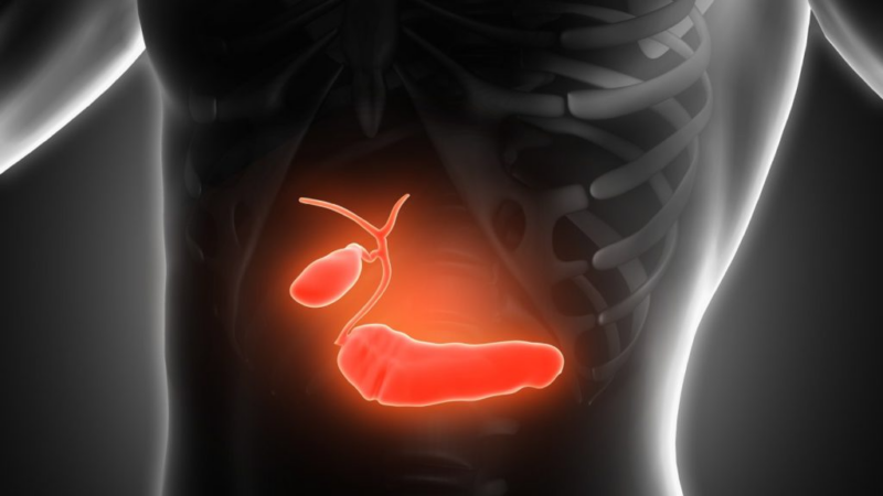 GemCis-NabPaclitaxel vs. GemCis in first line of advanced biliary tract cancers