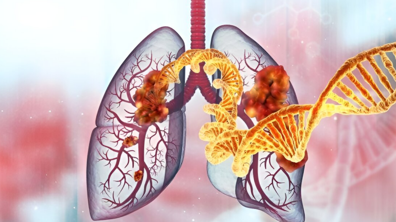 Diego A. Díaz García: First RCT in NSCLC with uncommon EGFR mutations – Afatinib VS Chemotherapy