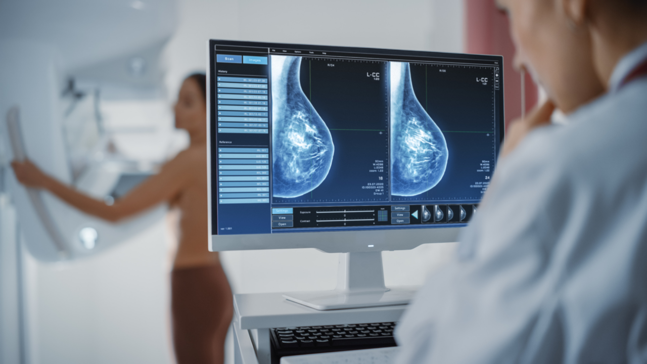 Implementation of AI for cancer detection in population-based mammography screening