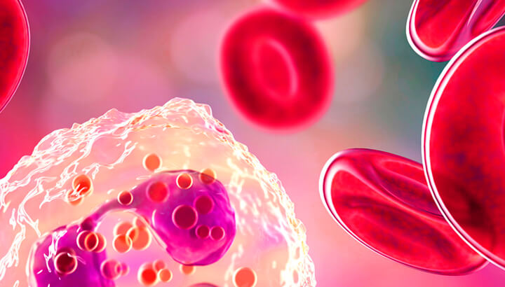 Marco Raddi – Associations of ESA response with erythroid precursors repartition and molecular features