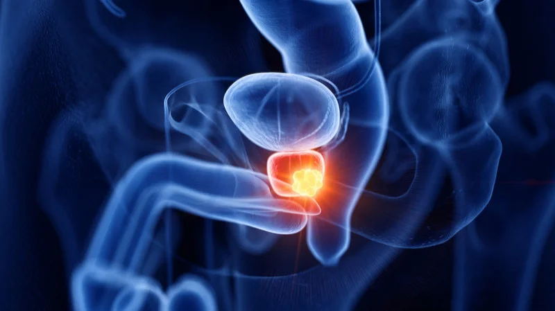 Elvina Almuradova: Metastasis-free or treatment-free survival