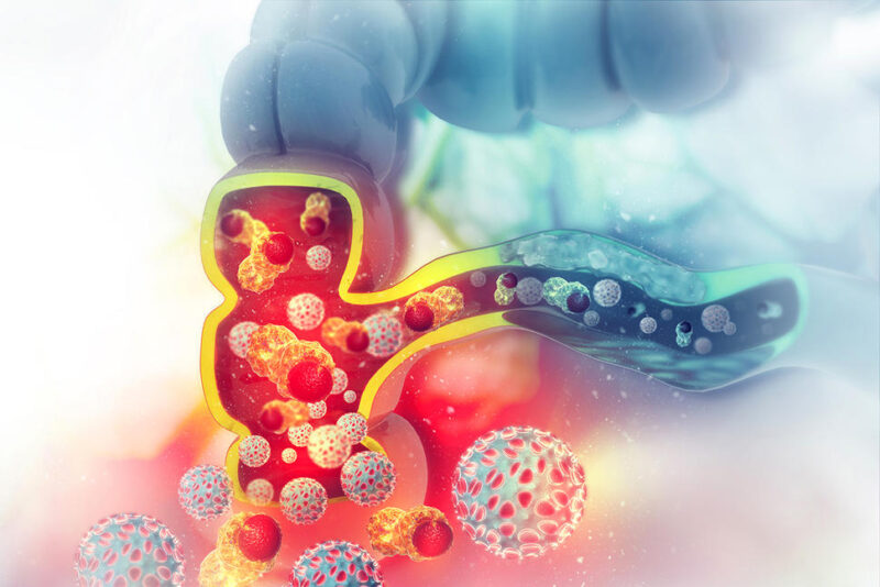 Oxaliplatin with Fluoropyrimidine/Bevacizumab for Initial Therapy for Unresectable mCRC in Older Patients