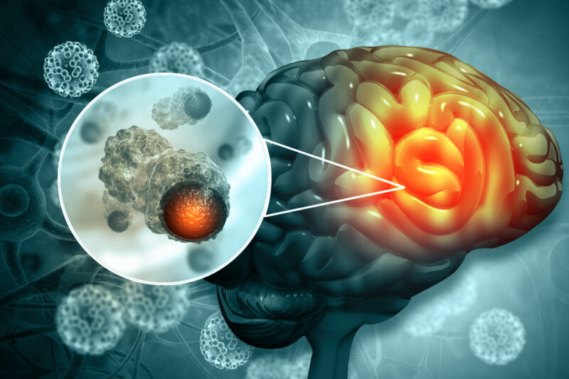 Mark Hughes Foundation Centre for Brain Cancer Research Announces Six MHF Innovation Grant Recipients