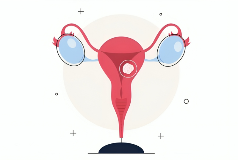 Senthil Kumar: First-Line Treatment in Advanced Endometrial Carcinoma