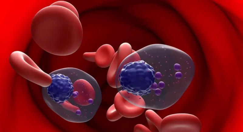 Shahrin Ahmed: The treatment of multiple myeloma is being improved