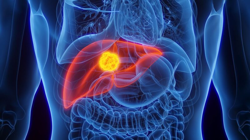 How PLT012 can Rejuvenate Antitumor Immunity to Reprogram the Immune landscape of Liver Cancer – Cancer Research Institute