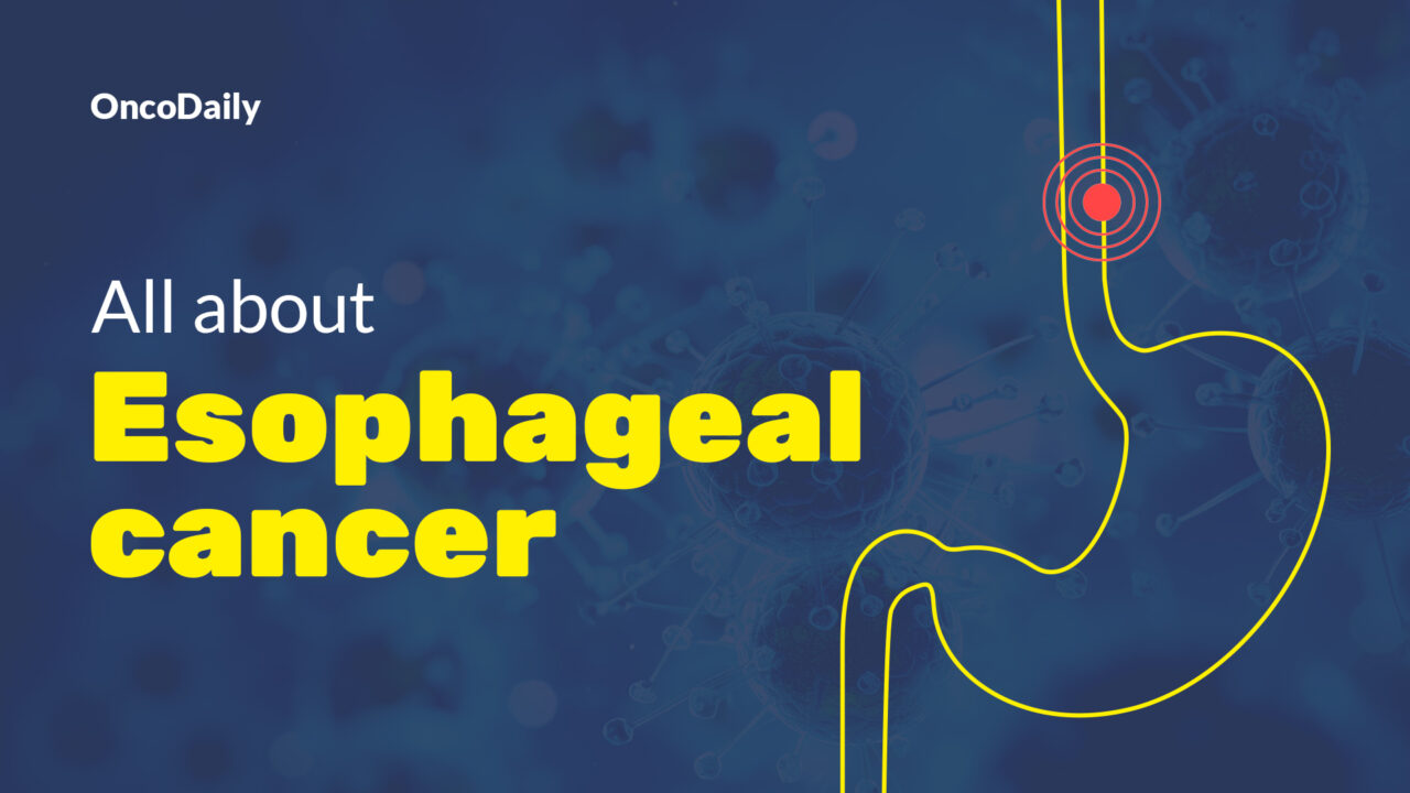 Esophageal Cancer: Symptoms, Causes, Stages, Diagnosis and Treatment