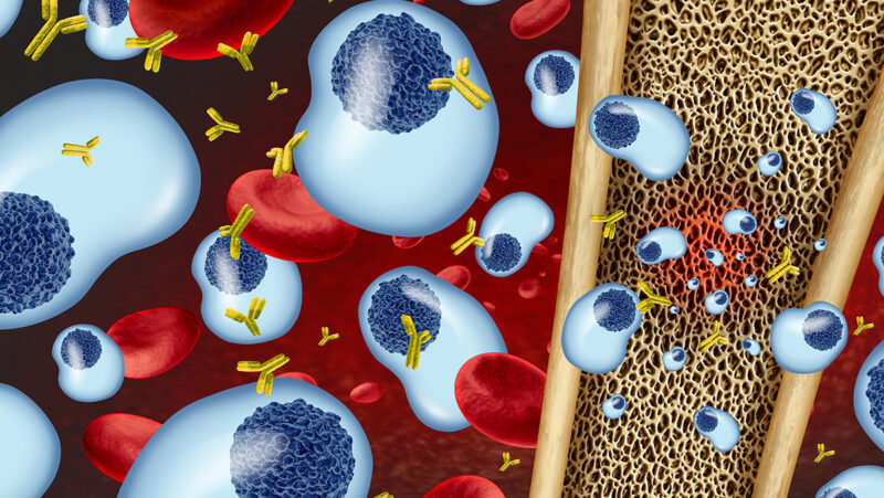 Major microbiome disruption and Toxicities Following Idecabtagene Vicleucel in Multiple Myeloma patients