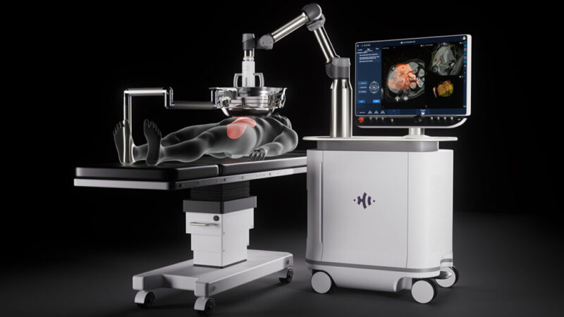 Vanderbilt-Ingram Cancer Center is one of the first centers in the Southeast to perform histotripsy