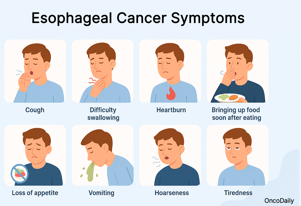 esophageal cancer symptoms