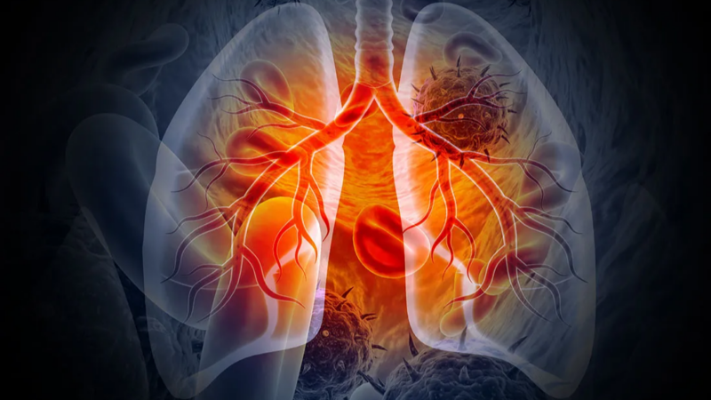Concurrent PIK3CA mutant drives cachexia through inflammatory signaling in EGFR mutant lung cancer