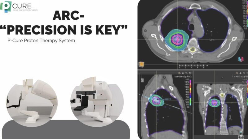lung tumors