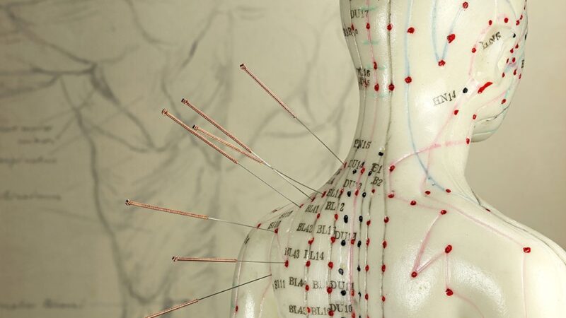 Control choice in acupuncture clinical trials involving patients with breast cancer by Barbara Bierer et al