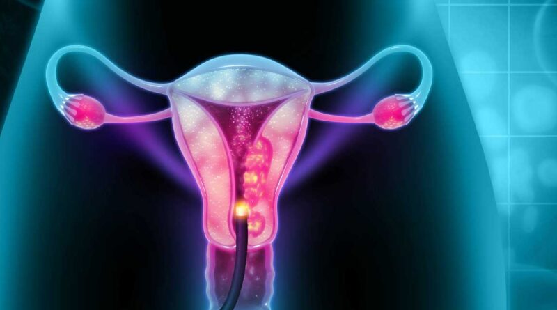 Senthil Kumar: First-Line Treatment in Recurrent / Metastatic Cervical Cancer