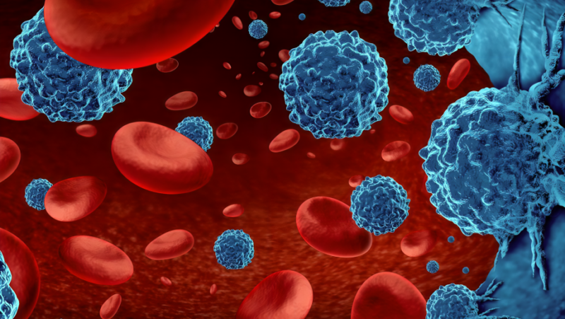 Predictive risk model of mild cognitive impairment in patients with malignant haematological diseases